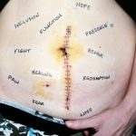 We did an empowering photo of her scar today with words taped around the scar. These words are her words to own. She chose each word. We can empathize, but we will never feel what she feels, we can imagine, but this is her pain, her recovery, her healing journey. She had right hemicolectomy surgery to remove a bit of small intestine, appendix, cecum, a huge mass they found in her cecum, her ascending colon, and a bit of her transverse colon. She has suffered from Crohn’s disease for almost 10 years.